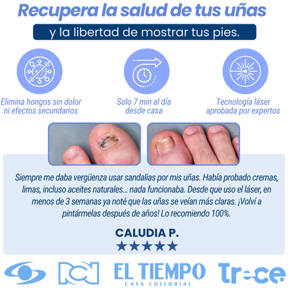 Adiós Hongos YA: Dispositivo no invasiso indoloro Elimina el hongo sin dolor (7 Dias / 99% de exactitud)